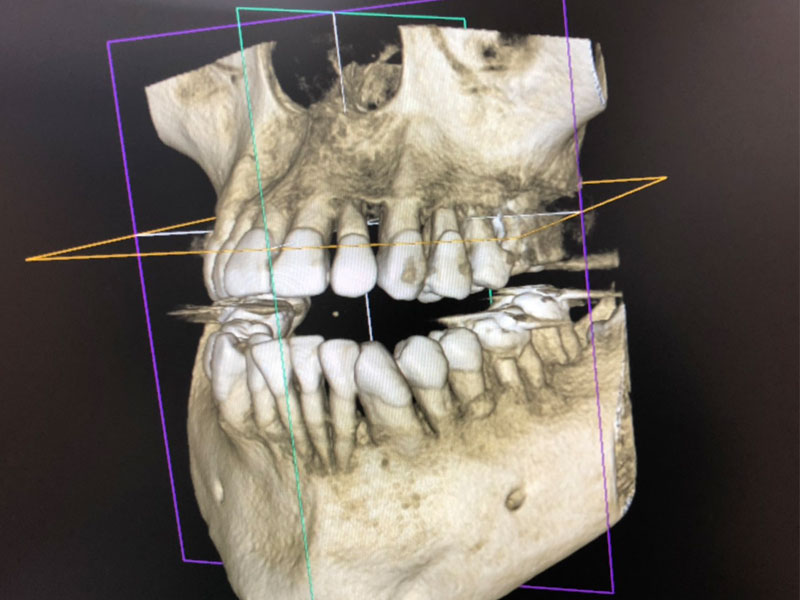 3DCT画像